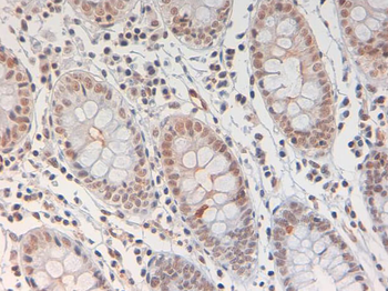 STAT3 phospho Y705 Antibody