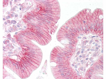 beta Catenin Antibody