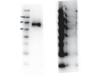 MST1R Antibody