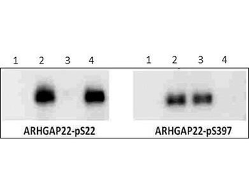Arhgap22 phospho S22 Antibody