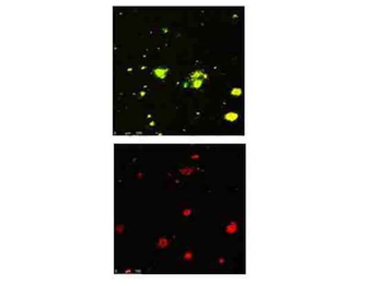 APP Antibody
