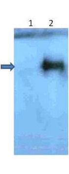 APP Antibody