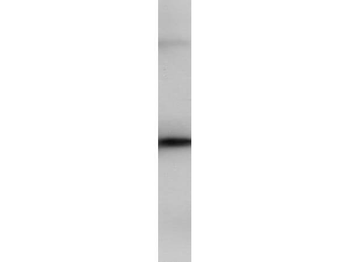 PIP4K2B Antibody