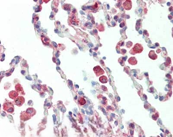 Protein Kinase C delta-Binding Protein Antibody