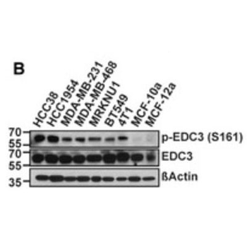 EDC3 phospho S161 Antibody