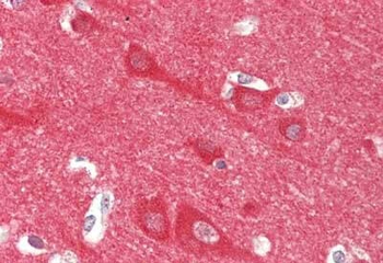 NCS1 Antibody