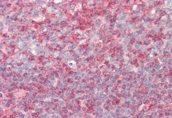 PIP5K1A Antibody