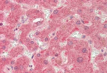 PI4KB Antibody