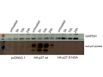 CDKN1B Antibody