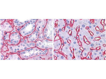 Collagen Type IV Antibody Peroxidase Conjugated