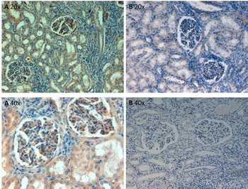 FN1 Antibody (Biotin)