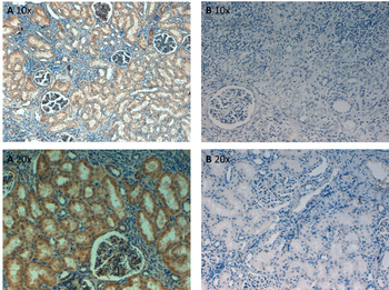 FN1 Antibody (Biotin)