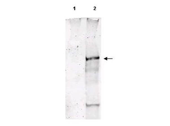 ATM phospho S1981 Antibody