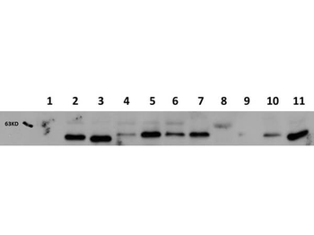 AKT1 Western Chemiluminescent Blotting Kit Antibody