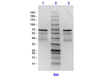 Surface Lipoprotein p27 Control protein