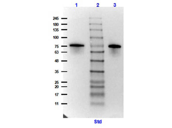 Surface Lipoprotein p27 Control protein