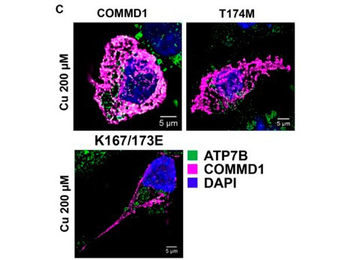 Human Transferrin protein (TRITC)