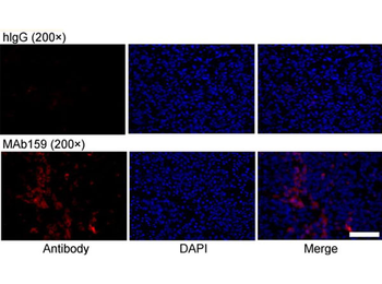 Human IgG Antibody