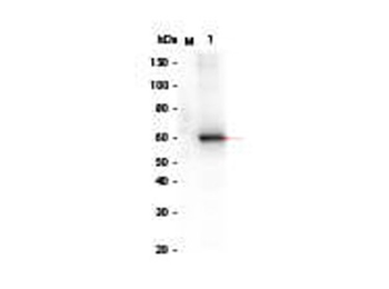 Human AKT2 (phosphatase treated) protein
