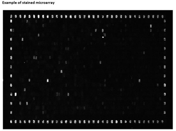 Human IgG (gamma chain) Antibody