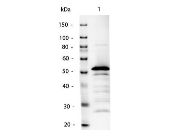 Mouse IgG2a (Gamma 2a chain) Antibody Alkaline Phosphatase Conjugated