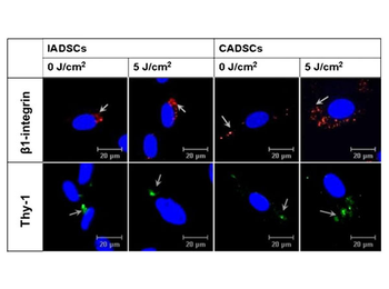 Mouse IgG1 (Gamma 1 chain) Antibody Texas Red Conjugated