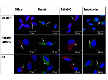Mouse IgG2a (Gamma 2a chain) Antibody Texas Red Conjugated