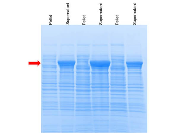 Proxtract B Extraction Buffer