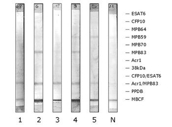 Protein A Alkaline Phosphatase Conjugated