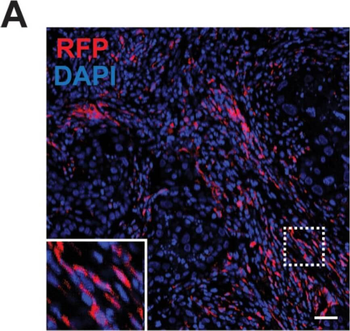 RFP Antibody