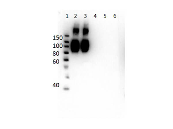 Hemoglobin A (beta chain) Antibody