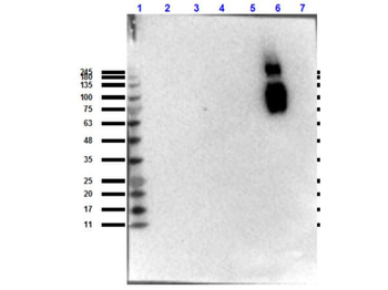 Hemoglobin beta S Antibody