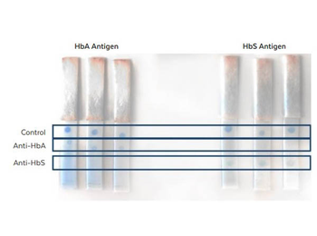 Hemoglobin beta S Antibody