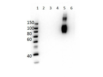 Hemoglobin beta F Antibody