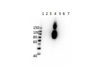 HBBc Antibody