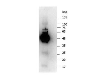 IKBKG Antibody