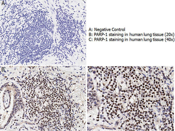 PARP1 (N-term ZF1) Antibody