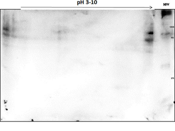 PARP1 (N-term ZF1) Antibody