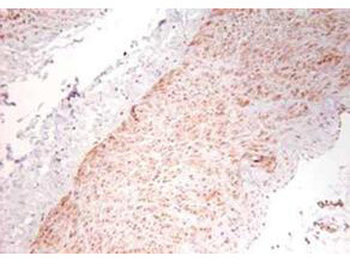 TNF alpha Antibody