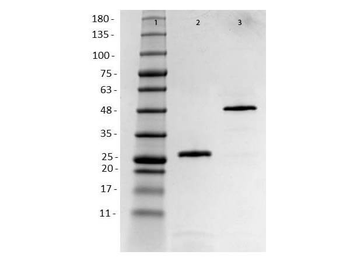 Recombinant Anti-HER2 Fab Antibody