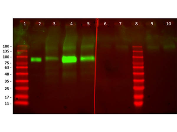 Recombinant Anti-HER2 Fab Antibody