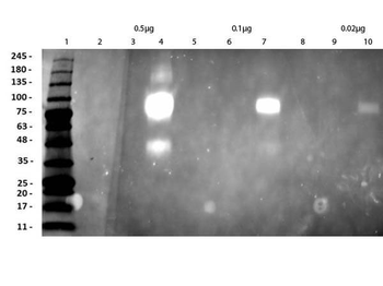 Recombinant Anti-HER2 Fab Antibody