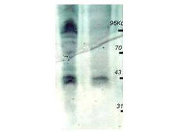 Phosphothreonine Antibody