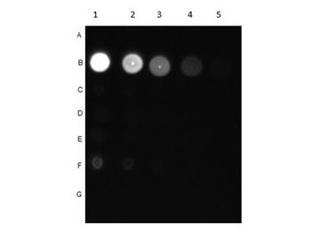 AKT phospho T308 Antibody
