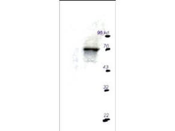 p70 S6 Kinase Antibody