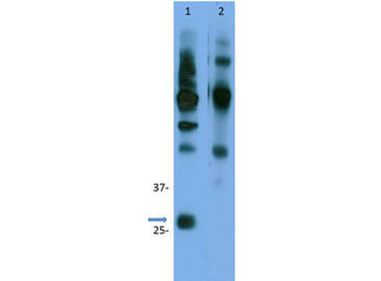 Ccnd3 Antibody