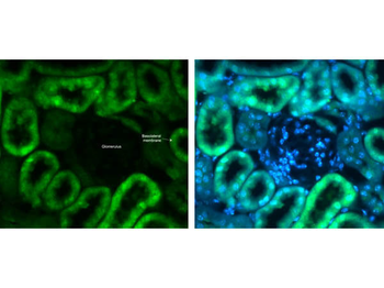 Slc2a2 Antibody