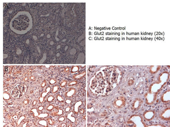 Slc2a2 Antibody