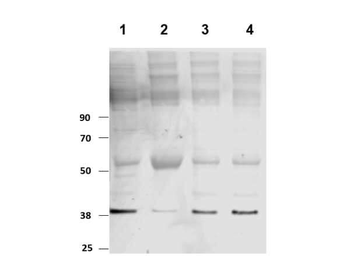 PKM Antibody