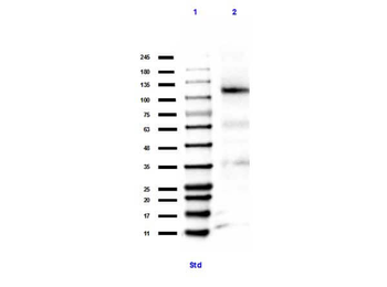 RB1 Antibody